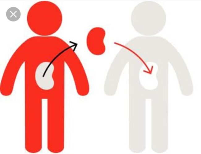 器官捐献和死后移植