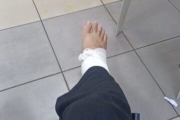 意外受伤，claim回医药费，还能再拿一笔钱